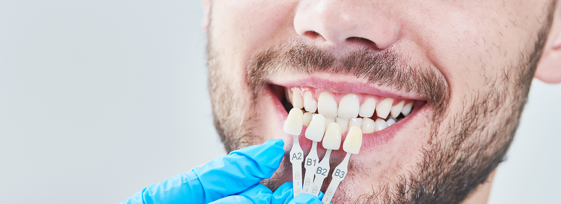 A man smiling in a dental setting, wearing a face mask and holding a toothbrush, with a tooth implant visible in his mouth.